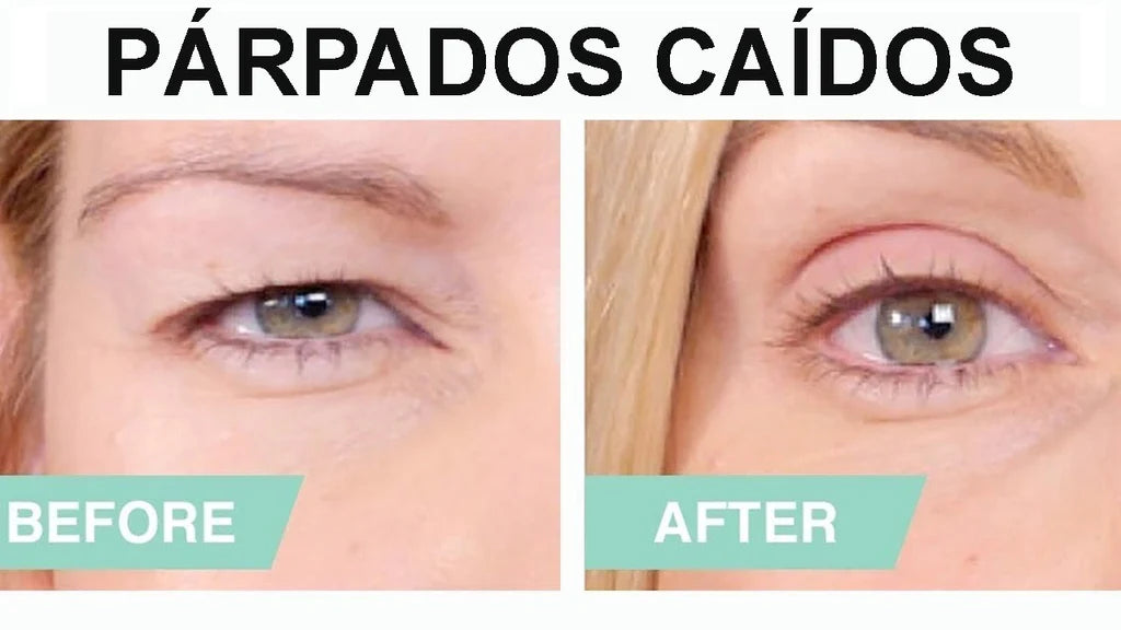 Cinta para párpado